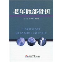 老年髖部骨折