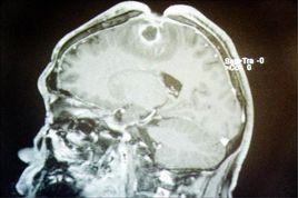 電子腦控 電子腦控