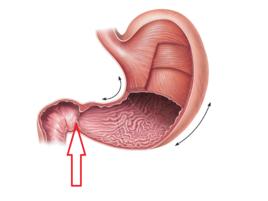 胃腸道穿孔 胃腸道穿孔