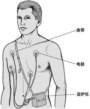 心電圖測量