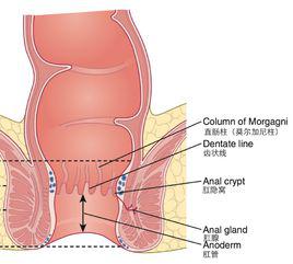肛管炎 肛管炎