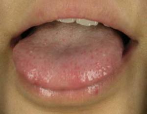 舌質