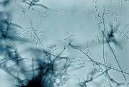 微黃綠鏈黴菌褐色變種 微黃綠鏈黴菌褐色變種