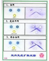 瓊脂擴散試驗 瓊脂擴散試驗