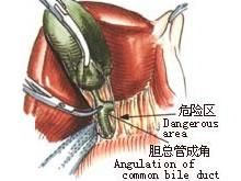 膽道運動功能障礙 膽道運動功能障礙