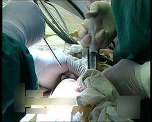 網路疑似整形照