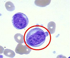 獲得性血小板功能障礙