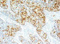 血清甲胎蛋白 血清甲胎蛋白