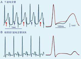 心理不應期 心理不應期