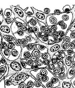 彌散性淋巴組織 彌散性淋巴組織