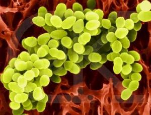 急性化膿性乳突炎