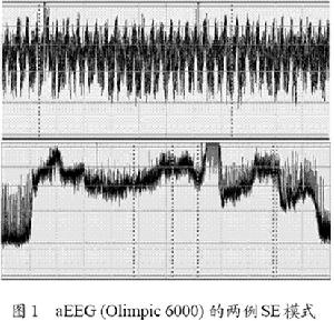 輕鏈病與輕鏈沉積病