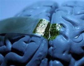 腦部植入電極 腦部植入電極