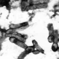 凝固芽孢桿菌 凝固芽孢桿菌