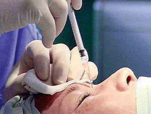 骨膜貼片 骨膜貼片