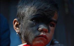 整形前的巴哈瓦娜·泰米