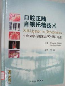 口腔正畸自鎖托槽技術 口腔正畸自鎖托槽技術