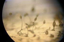 土壤放線菌 土壤放線菌