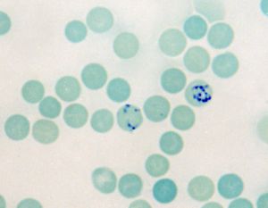 網織紅細胞生成指數