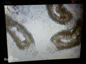 剝隘指環蟲 剝隘指環蟲