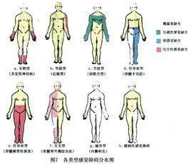 感覺障礙 感覺障礙