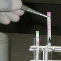 復發性無菌性腦膜炎