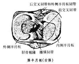 膝半月板損傷 膝半月板損傷