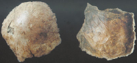 “許昌人”頭蓋骨化石