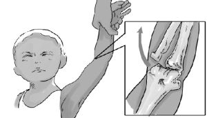 這個動作最容易脫臼