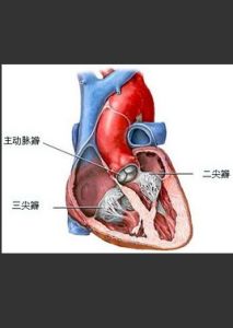 心臟瓣膜手術