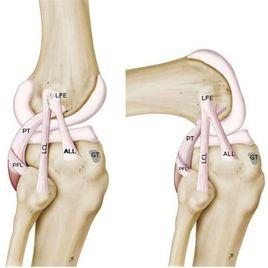 膝交叉韌帶