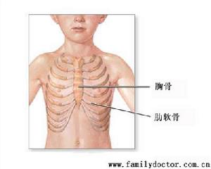 先天性胸骨旁疝