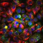 原發性中樞神經系統腫瘤