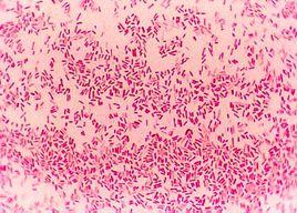 鴿大腸桿菌病 鴿大腸桿菌病