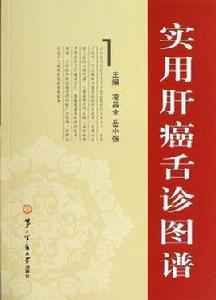 實用肝癌舌診圖譜 實用肝癌舌診圖譜