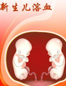 新生兒溶血病