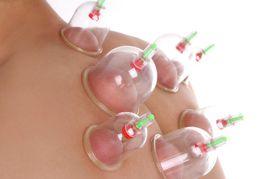 真空磁療拔罐器 真空磁療拔罐器