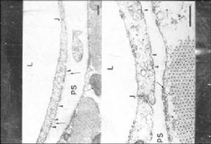 單組分豬胰島素