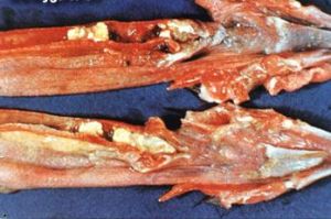 雞傳染性喉氣管炎——病雞喉部