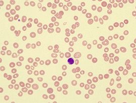 中度貧血 中度貧血