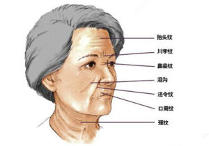 面部皺紋分類圖