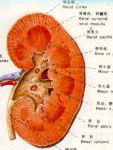 腎鈣化 腎鈣化