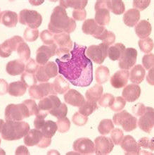 異形細胞 異形細胞