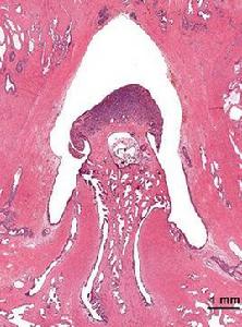 神經元特異性烯醇化酶 神經元特異性烯醇化酶