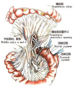 十二指腸懸韌帶 十二指腸懸韌帶
