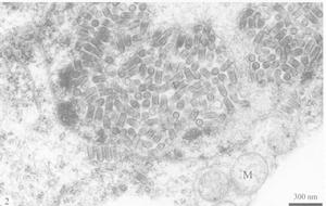 感染水稻黃矮病毒的水稻葉片薄壁細胞