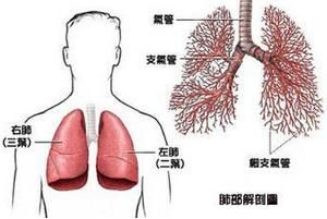 支氣管肺癌