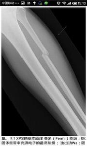 身體透視掃瞄器 身體透視掃瞄器