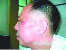 10·10湖南衡陽官員互毆事件 10·10湖南衡陽官員互毆事件