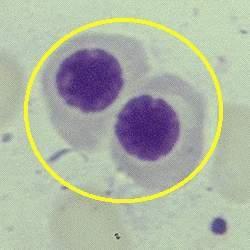 晚幼紅細胞 晚幼紅細胞